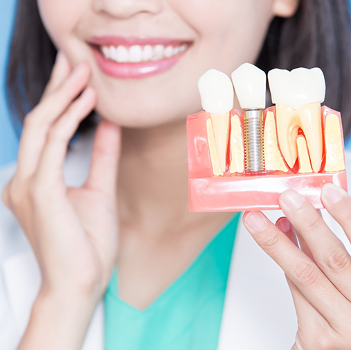 Close up of woman holding a dental implant model