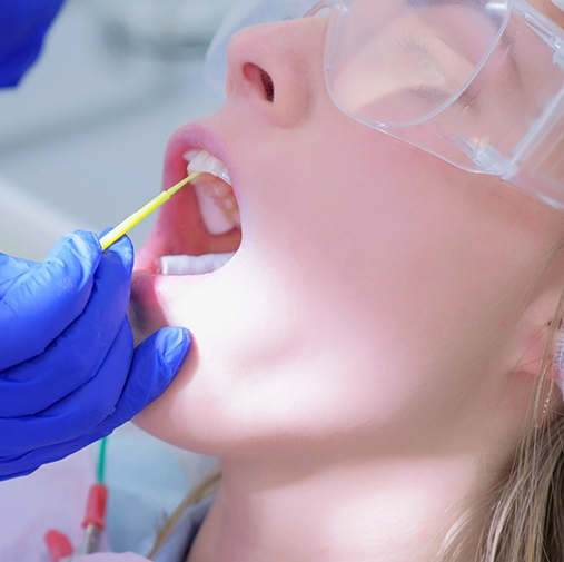 Woman having fluoride applied to upper teeth