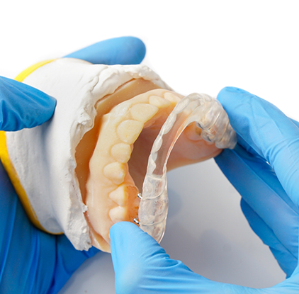 Placing occlusal splint on model of teeth